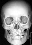 3D-КТ: высокий уровень лучевой визуализации состояния опорных тканей лицевого и мозгового черепа